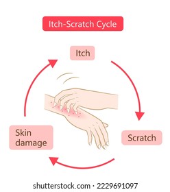 itch scratch cycle hands illustration. Dry, dermatitis and atopic eczema condition. Healthy skin care concept