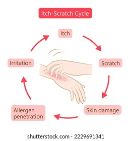 itch scratch cycle hands illustration. Dry, dermatitis and atopic eczema condition. Healthy skin care concept