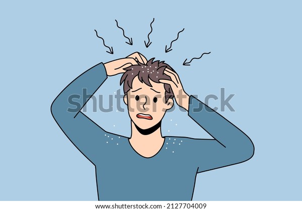 Itchy head and dandruff concept.\
Stressed irritated man standing and having itchy scalp feeling\
problems with health and scratching hair vector illustration\
