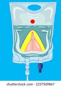IV bag. The infusion system. A metaphor. Relax and the sea.