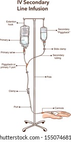 IV Secondary Line Infusion vector illustration