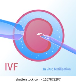 IVF. Artificial insemination. Realistic vector design 3d