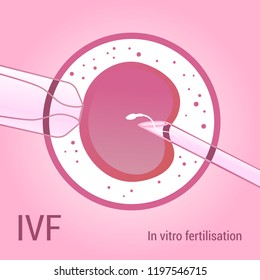 IVF. Artificial insemination. Realistic vector design 3d