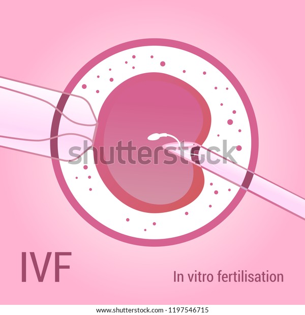 Ivf Artificial Insemination Realistic Vector Design Stock Vector