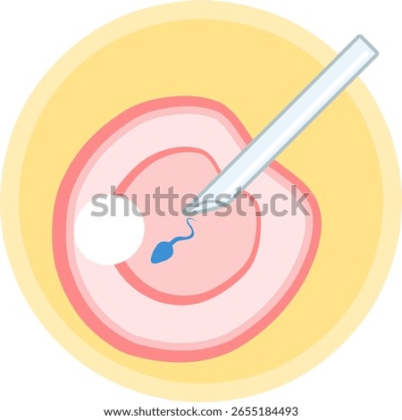 IVF ICSI vector illustration. Perfect for presenting anything about reproduction, insemination or ivf. Vertical position with yellow background.
