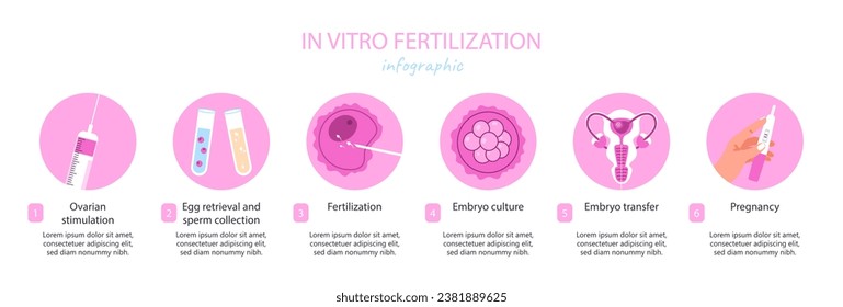 IVF infographic concept. Fertilization and ovulation. Reproductive system and health care. Gynecology, anatomy and biology. Cartoon flat vector illustration isolated on white background