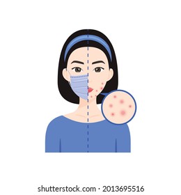 Japanese, Korean, Chinese Woman Wears Medical Mask on Face. Asian Lady and Problem Skin. Acne, Pimples. Flat color Cartoon style. White background. Illustration for Medical, Beauty Design. Vector