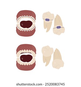 Maxila com aparelho e dentes naturais: uma comparação ortodôntica