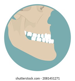 Jaw Surgery chin implant Sleep Apnea snoring upper airway plastic facial Cranio TMD TMJ joint Overbite teeth dental birth defects Open bite pain trauma cosmetic gummy smile bone reconstructive bad