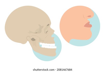 Jaw Surgery chin implant Sleep Apnea snoring upper airway plastic facial Cranio TMD TMJ joint Overbite teeth dental birth defects Open bite pain trauma cosmetic gummy smile bone reconstructive bad