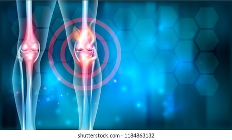 Joint ache problems abstract blue background with abstract fire