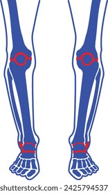Joint Arthritis, Joint Inflammation, Joint Pain