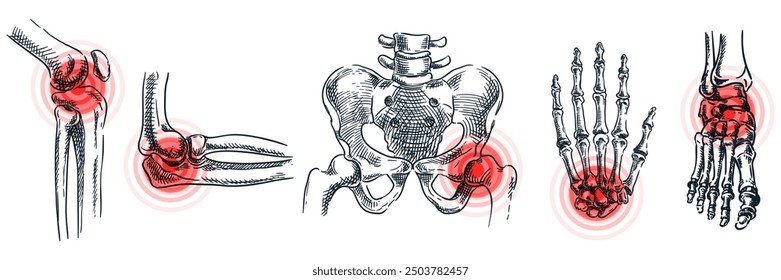 Joint arthritis, osteoporosis, bone disease and inflammation. Abstract pain localization symbol. Vector sketch illustration. Hand drawn doodle anatomy symbols set isolated on white background