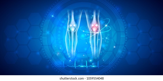 Joint damage treatment abstract blue background with beautiful glow and normal cardiogram at the bottom