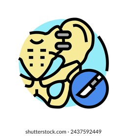 joint fusion surgery color icon vector. joint fusion surgery sign. isolated symbol illustration