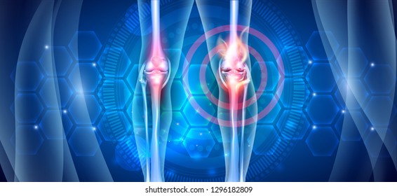 Joint knee problems diagram on an abstract blue scientific background with abstract fire, joint ache concept