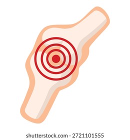 Dolor articular resaltado con blanco rojo que indica la ubicación del dolor, el concepto de artritis, lesión, inflamación y atención médica