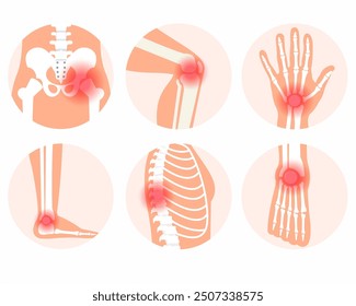 Dolor articular en el cuerpo humano Dolor de rodilla, columna vertebral y otros dolores articulares	
