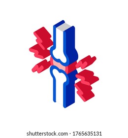 Gelenkschmerzsymbol Vektor. Isometrisches Schmerzzeichen. farbige einzelne Symbolillustration