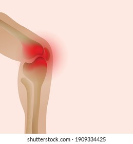 Joint pain illustration. Bone pain. Ache. Arthritis. Orthopedic medical concept.