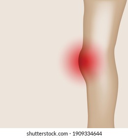 Joint pain illustration. Bone pain. Ache. Arthritis. Orthopedic medical concept.