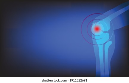 Joint pain illustration. Bone pain. Ache. Arthritis. Orthopedic medical concept.