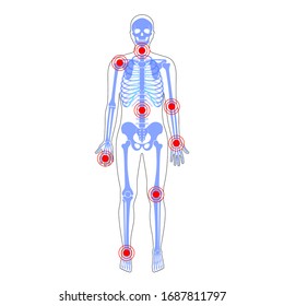 Joint pain on skeleton in human body. Ache or injury localization. Vector flat illustration. Knee, spine, shoulder inflammation symbol. Arthritis, rheumatism concept. Medical, educational banner
