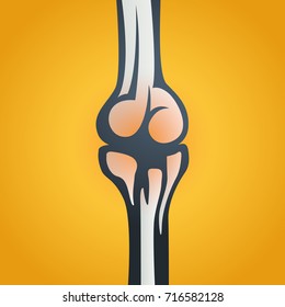 JOINT PAIN vector icon illustration