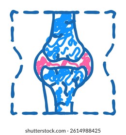 joint problem doodle icon sketch vector. joint problem sign. isolated symbol illustration