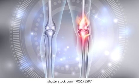 Joint problems bright abstract 3d illustration, burning damaged knee 