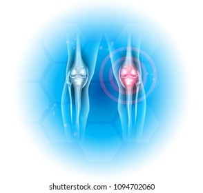 Joint problems illustration, transparent legs with joints on a beautiful light blue background