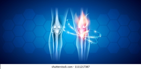 Joint problems and treatment abstract scientific background 