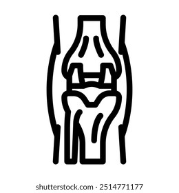 Icono de línea de cirugía de reemplazo de articulaciones. Vector de cirugía de reemplazo de articulaciones. Contorno aislado Ilustración negra