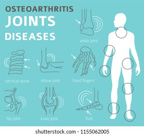 Joints Diseases. Arthritis, Osteoarthritis Symptoms, Treatment Icon Set. Medical Infographic Design. Vector Illustration