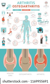 Joints diseases. Arthritis, osteoarthritis symptoms, treatment icon set. Medical infographic design. Vector illustration