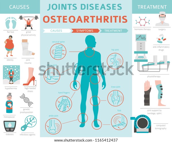 osteoartritis+sintoma+de+la+osteoartritis