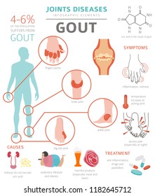 Joints diseases. Gout symptoms, treatment icon set. Medical infographic design. Vector illustration