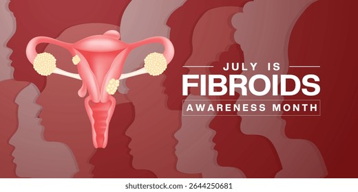Julho É O Mês De Conscientização Sobre Os Fibroides. Órgãos reprodutivos femininos e fêmeas. Adequado para cartazes, banners e mídias sociais. Fundo branco.