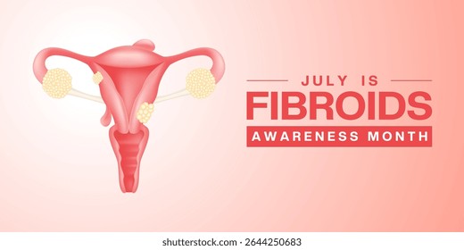Julho É O Mês De Conscientização Sobre Os Fibroides. Órgãos reprodutivos femininos. Adequado para cartazes, banners e mídias sociais. Fundo branco e rosa.