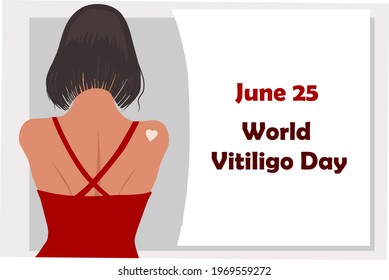 June 25 - World Vitiligo Day. Pigmentation disorders. Skin depigmentation. Vector illustration on the theme of rare diseases. Chronic skin disease.