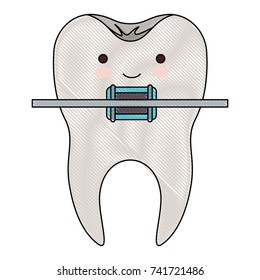 kawaii tooth with root and brace colored crayon silhouette vector illustration