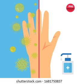 Keep your hands clean. One half is dirty hand fully with coronavirus germs and one is very clean. banner about hygiene. novel disease covid-19, 2019-ncov, mers-cov