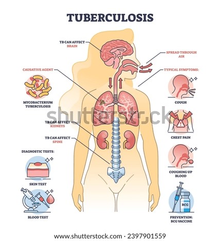 Key aspects of tuberculosis or TB bacterial lung illness outline diagram. Labeled educational scheme with respiratory disease with cough, chest pain and coughing up blood symptoms vector illustration