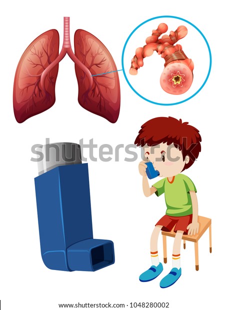 Kind Mit Asthmapuffer Und Lungenanatomie Stock Vektorgrafik Lizenzfrei