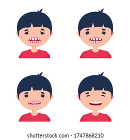 A kid before and after using dental aligner braces. Corrective treatment of a child. A process of crooked teeth alignment. Little boy being sad and happily smiling.