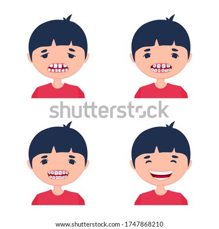 A kid before and after using dental aligner braces. Corrective treatment of a child. A process of crooked teeth alignment. Little boy being sad and happily smiling.
