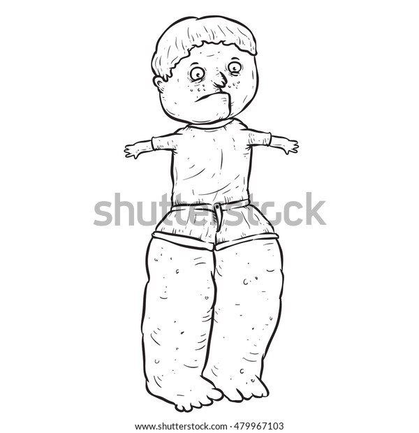 Kid Got Elephantiasis Sickness Stock Vector Royalty Free 479967103