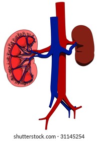 kidney cut