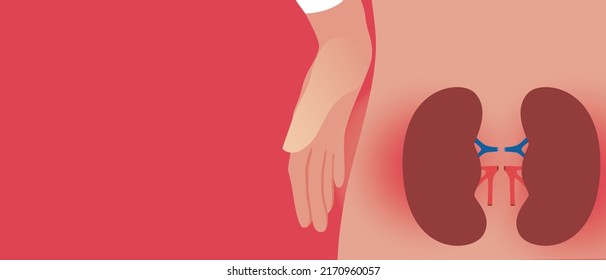 Kidney Disease. Anatomical Vector Stock Illustration With Space For Text. Persona And Inflammation Of Kidneys. Pain In Body. Copy Space Template