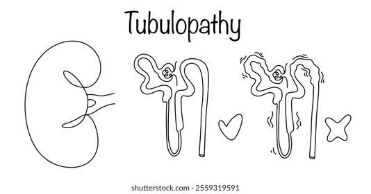Kidney disease associated with dysfunction of the renal tubules - tubules. Drawn kidney, healthy tubules and tubulopathy disease. Simple vector illustration on a medical theme.